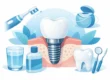 How to Care for Dental Implants Every Day