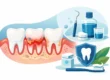 Gum Disease: Signs, Treatment, and Prevention