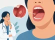 Oral Cancer: Signs You Should Never Ignore
