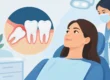 Wisdom Teeth and When Removal Makes Sense
