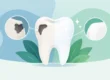 Can Cavities Heal Naturally? What Teeth Can Repair